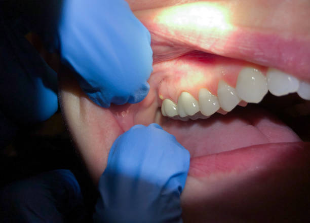 Best Emergency Treatment for Toothache in Diamond, IL